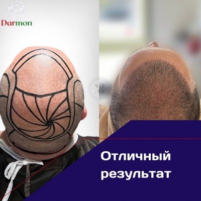 DARMON CENTER