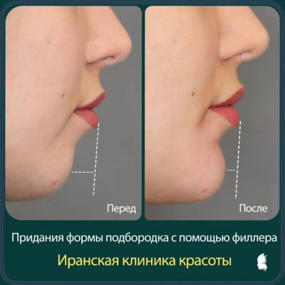 Иранская клиника красоты